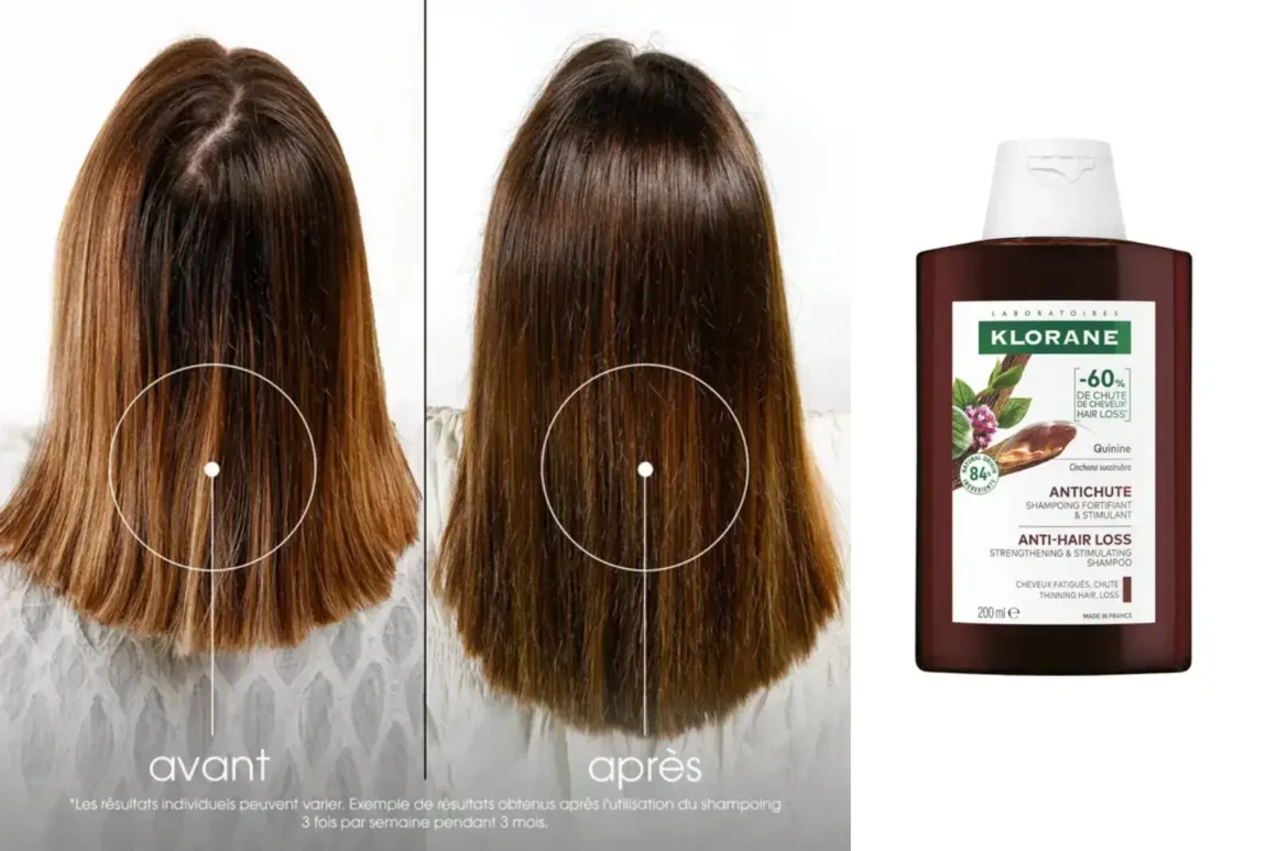 Klorane antichute femme avant-après