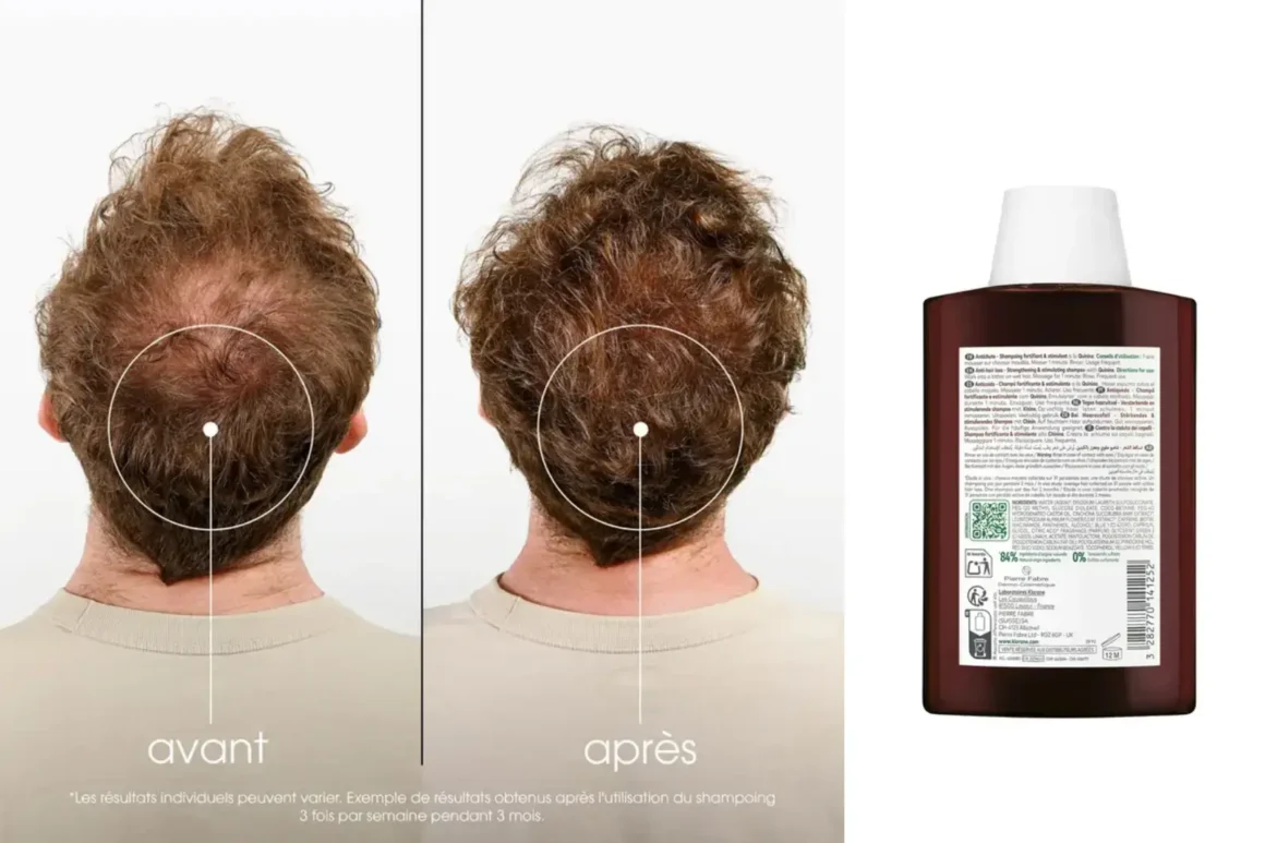 Klorane antichute homme avant-après